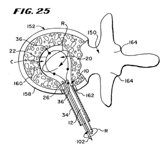 Figure 25 of the 672 Patent